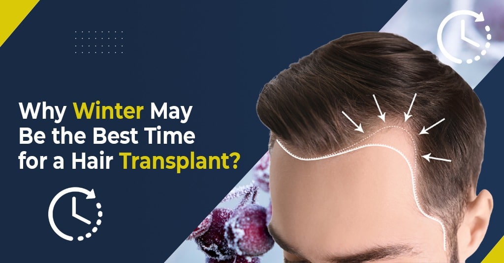 Winter May be the Best Time for Hair Transplant?