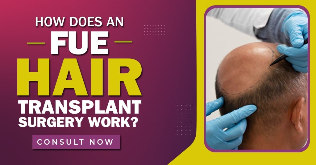 How does an FUE hair transplant surgery work?