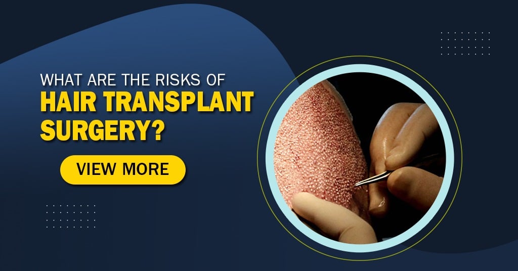 Risks Of Hair Transplant Surgery