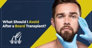 What should I avoid after a Beard Transplant?