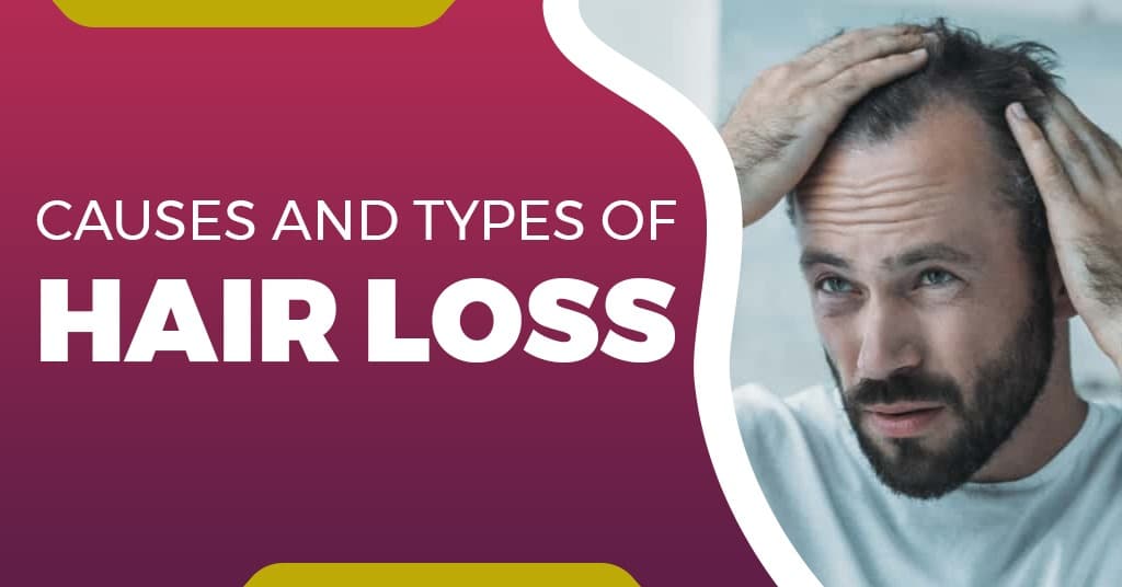 Causes and Types of Hair Loss