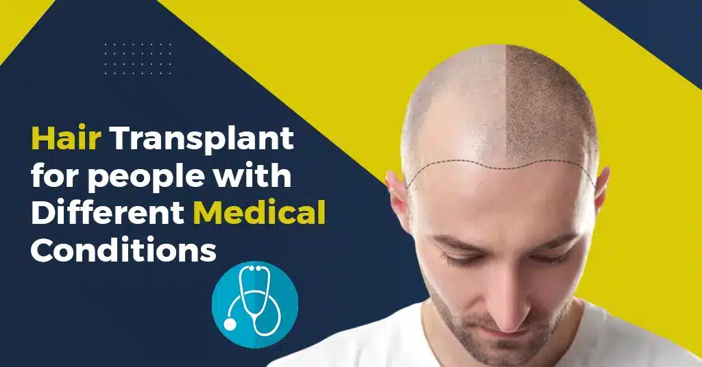 Hair Transplant for People with Different Medical Conditions