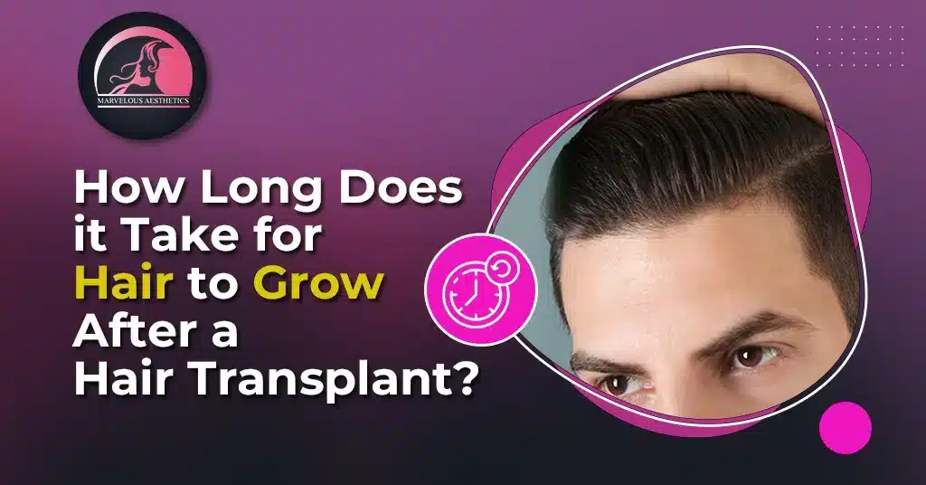 How Long does it take for Hair to Grow after a Hair Transplant?