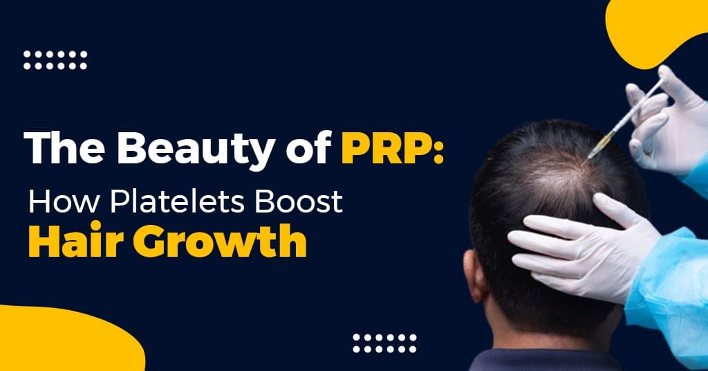 The Beauty of PRP: How Platelets Boost Hair Growth