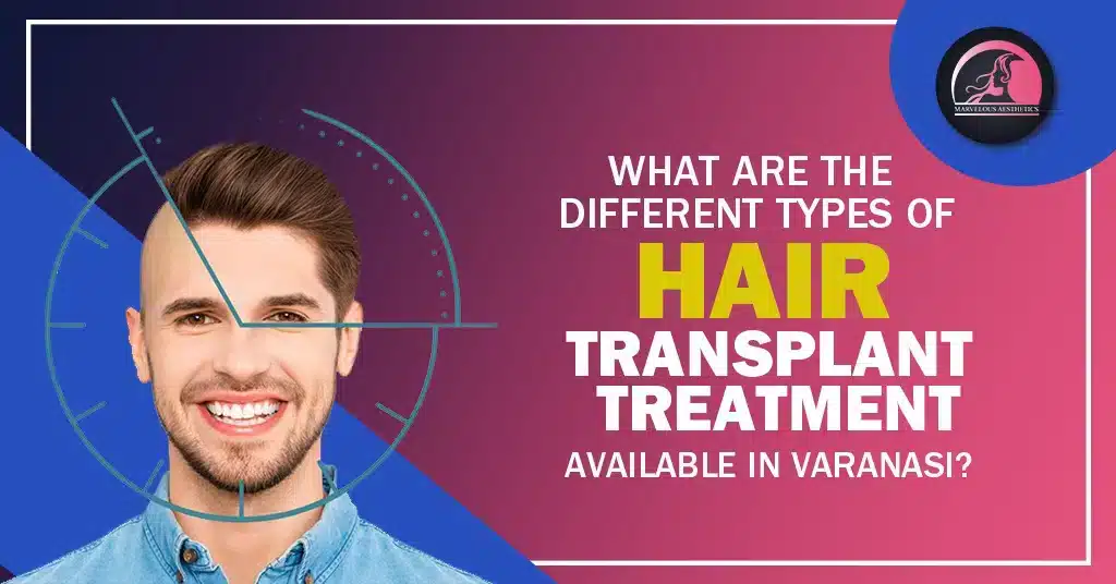 What Are The Different Types Of Hair Transplant Treatment Available in Varanasi?