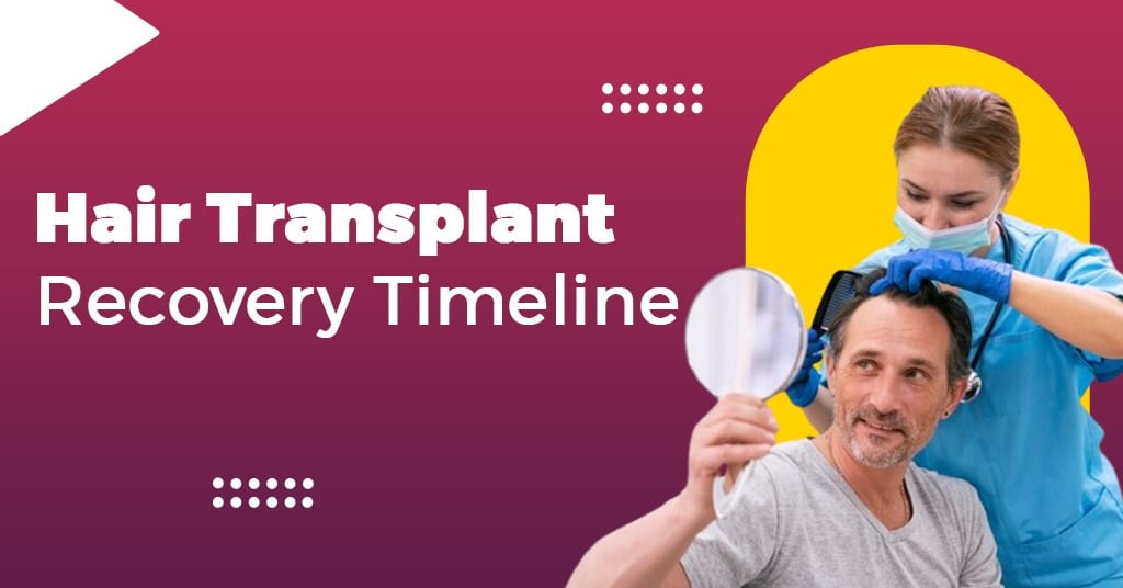 Hair Transplant Recovery Timeline: A Detailed Guide to Your Journey to Fuller Hair