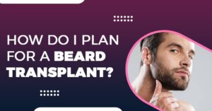 How do I plan for a Beard Transplant?