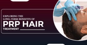 Exploring the Long-Term Benefits of PRP Hair Treatment