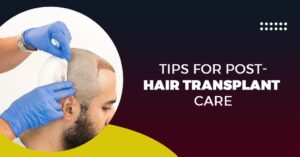 Tips for Post-Hair Transplant Care