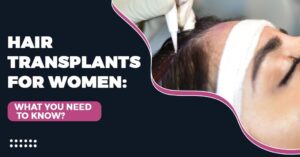 Hair Transplants for Women: What You Need to Know