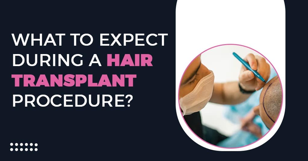 What to Expect During a Hair Transplant Procedure?