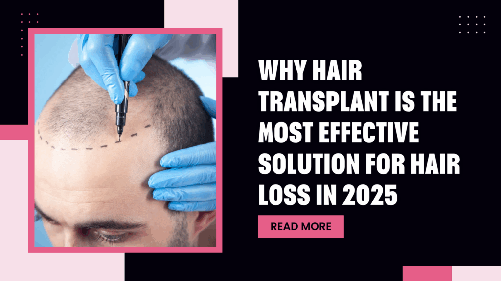 Hair Transplant Cost in Varanasi